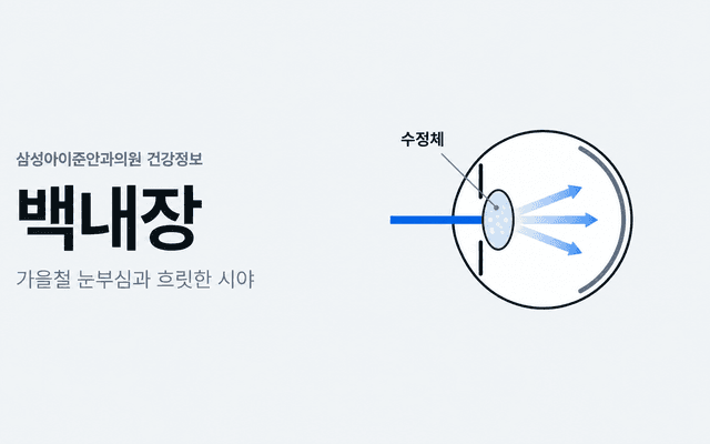 백내장과 가을철 눈부심·흐릿한 시야를 설명하는 커버. 왼쪽에는 제목, 오른쪽에는 수정체 혼탁으로 빛이 퍼지는 눈 단면 도식이 배치되어 있습니다.