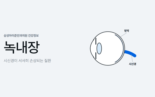 눈 뒤쪽의 시신경을 강조한 눈 단면 그림